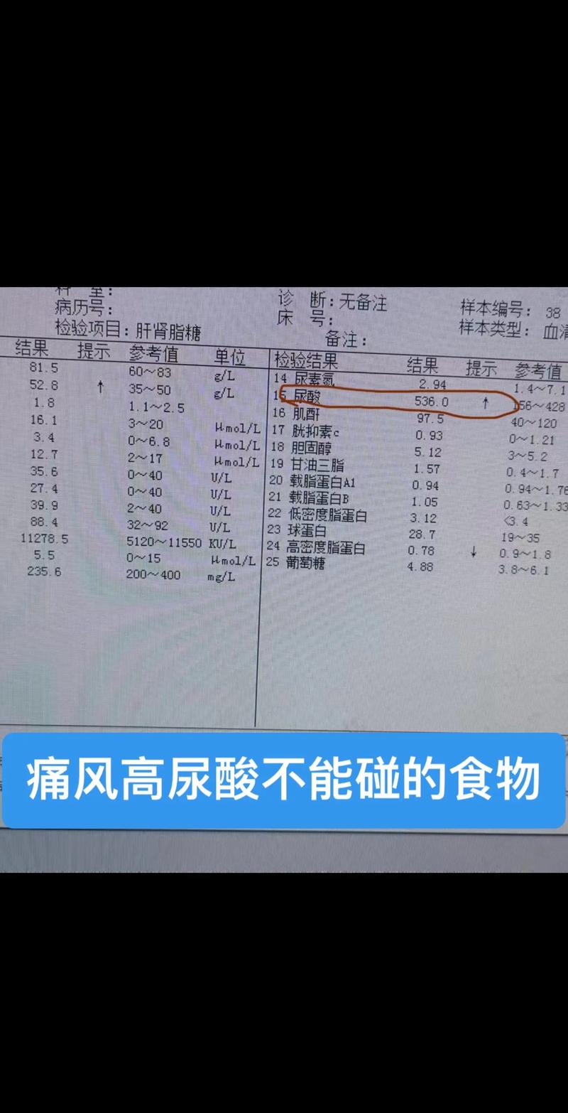 什么是尿酸通俗的说法:什么是尿酸尿酸是怎么形成的
