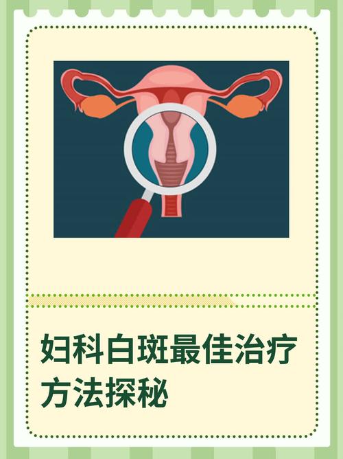 妇科病白斑能治愈吗:妇科病白斑是一种什么病