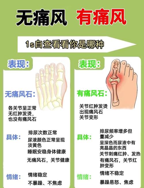 尿酸自测最简单方法:尿酸自测最简单方法是肌酐吗