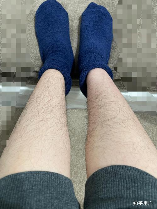 什么是体毛:什么是体毛旺盛