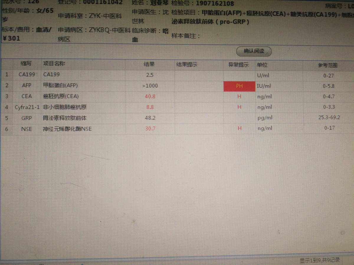血生化TG_血生化TG是301
