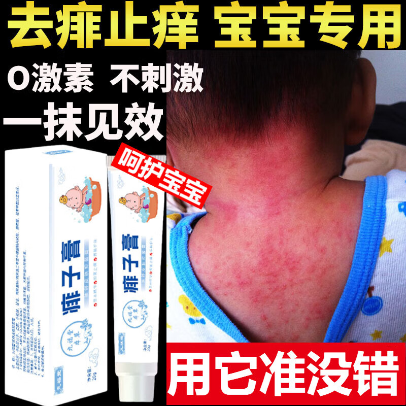 儿童去痱子止痒最有效的方法_儿童去痱子止痒最有效的方法有哪些