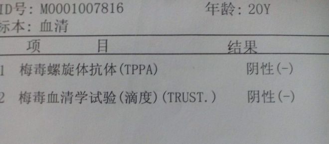 梅毒过筛实验trust，梅毒过筛实验coi值是什么检测方法